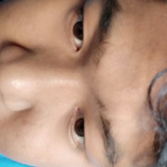 gunk alit