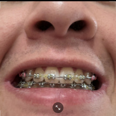 LIL JONK