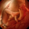 fetus diva
