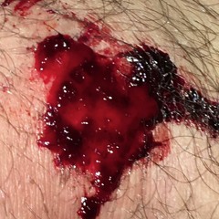 metal in empty head