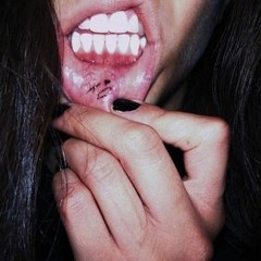 flashes