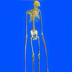 rich bones