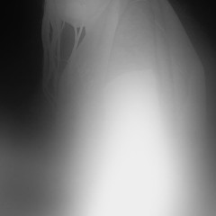 ennui23