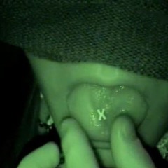 asdasdasd\]