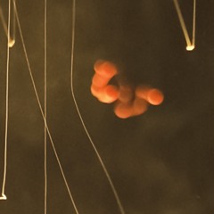 Nercosis
