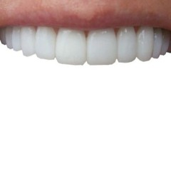 yyy