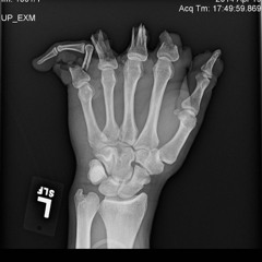 Social Cares - Brand  Weight - Mayo Choice Excess