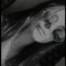 FrixBlue