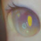 mish