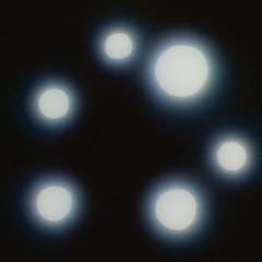 Sclera Iris