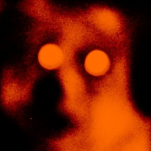 SoundCloud bots can suck my fucking dick