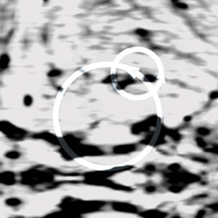epicycle