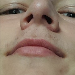ioni