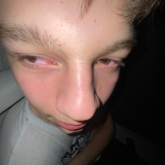 Kniescheibenflexer Nossi