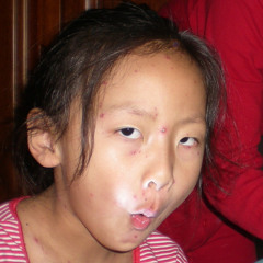 Tingenera1