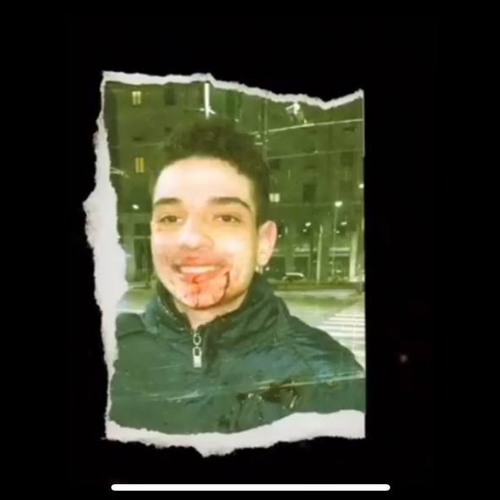 Simbalarue fenicottero (BOTOX)