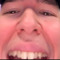 Benedikt
