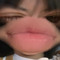 chin