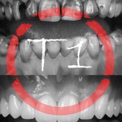 #T1