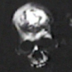 Skeleton Man