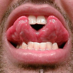mossyhole