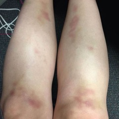 @нимбнадповешеннойголовой