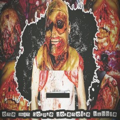 Medical Teratocarcinoma Anus