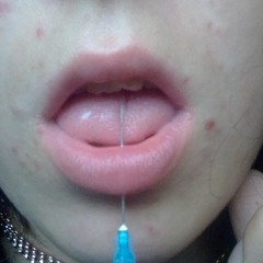 _.xanox._