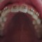scumilk