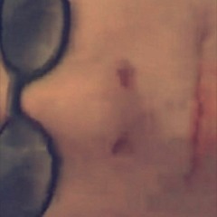 BAAP ALM