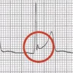 elricfddddddddddddddddddddddddddddddddddd