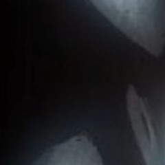 svpra