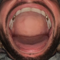 Kyle Collide