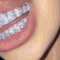 LIPS