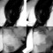 Litx Ya