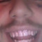SLM