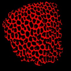 xxeroderma