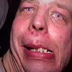 pure putrid stink