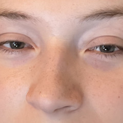pyrogy