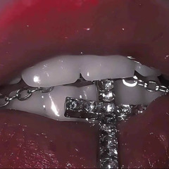 Vynx