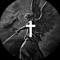 ZONOX™