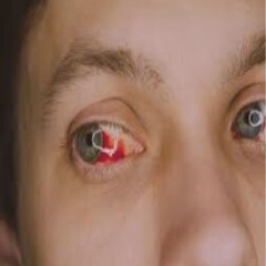 r3deye