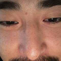 Yupinpi