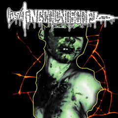 Vibrating Colonoscopy