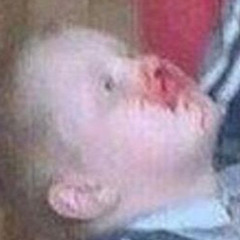 Skinweed Corp. Media