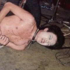 Swollen Plantar Fascia