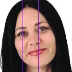 Noe