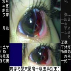 느금마후장에전기파리채삽입