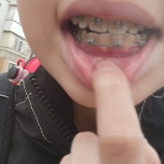 чо даун чтоли