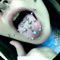 izzyrotten